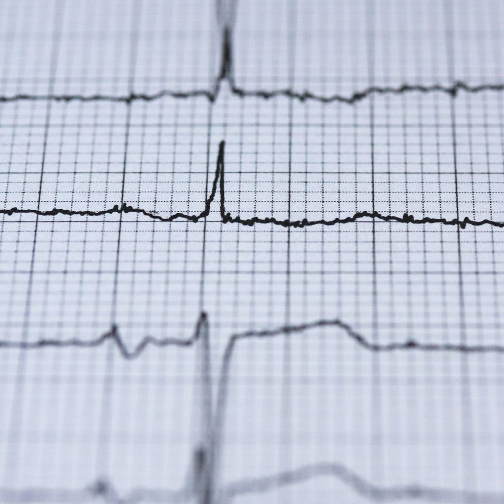 Wykonanie i interpretacja zapisu elektrokardiograficznego u dorosłych